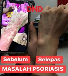 testid3k2-1